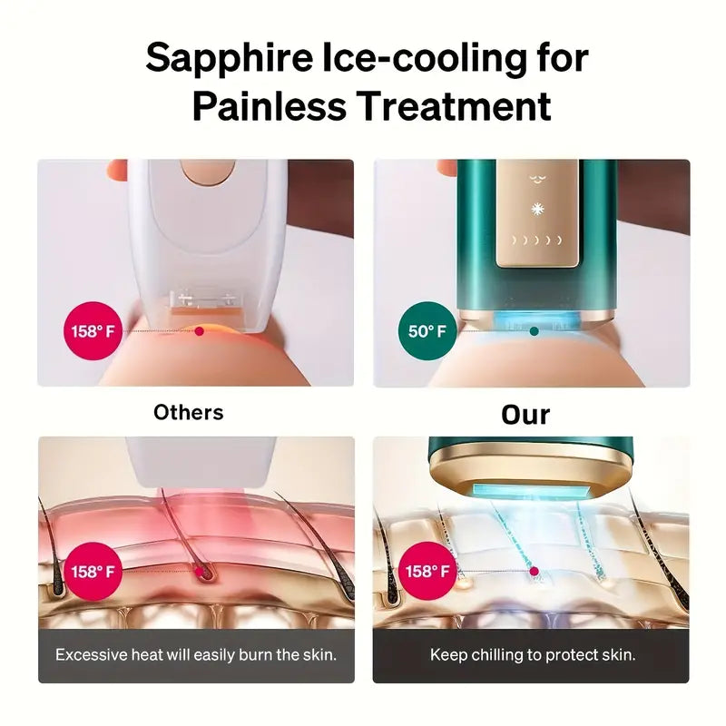 Ice Glide IPL Hair Removal
